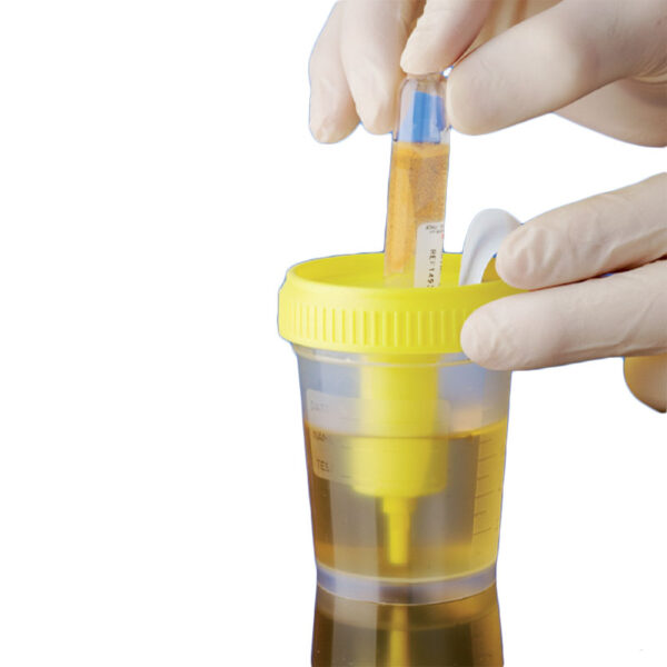 Urinprøvekit vakuum overførsel af urin